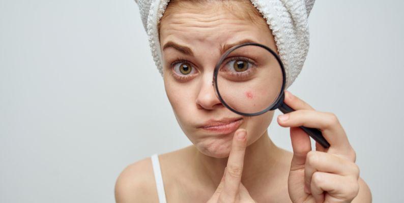 clear up acne with tea tree oil